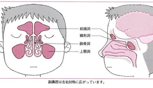 サーフィン後に鼻から海水がドバドバ出る現象