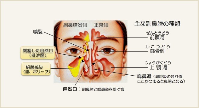 鼻腔 炎 ヤクルト 副